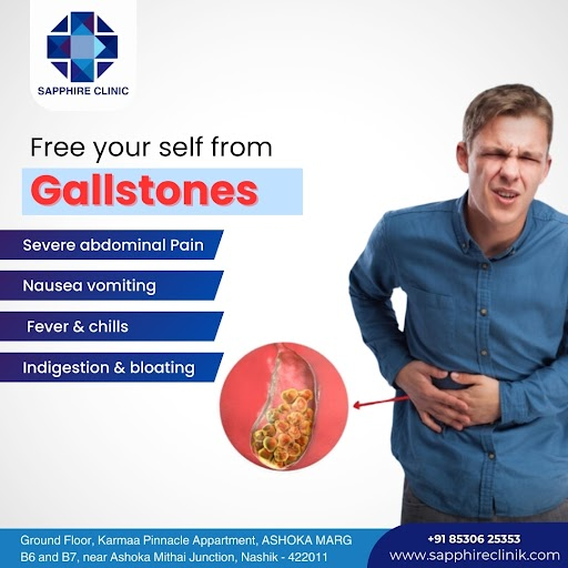 Gallstones treatment in Nashik