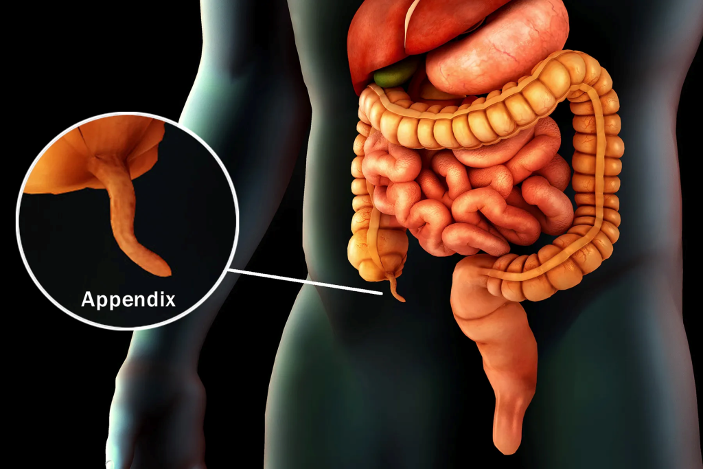 Appendix treatment in Nashik