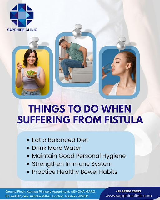 Best FISTULA Treatment in Nashik